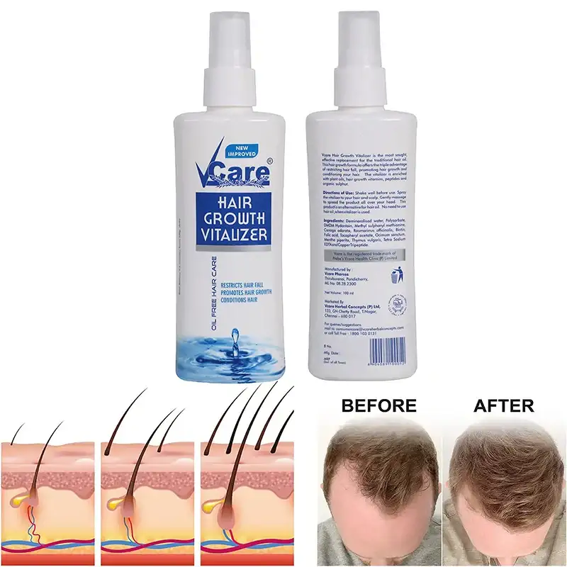 best hair vitalizer,hair vitalizer,hair growth serum,hair vitalizer,best hair vitalizer